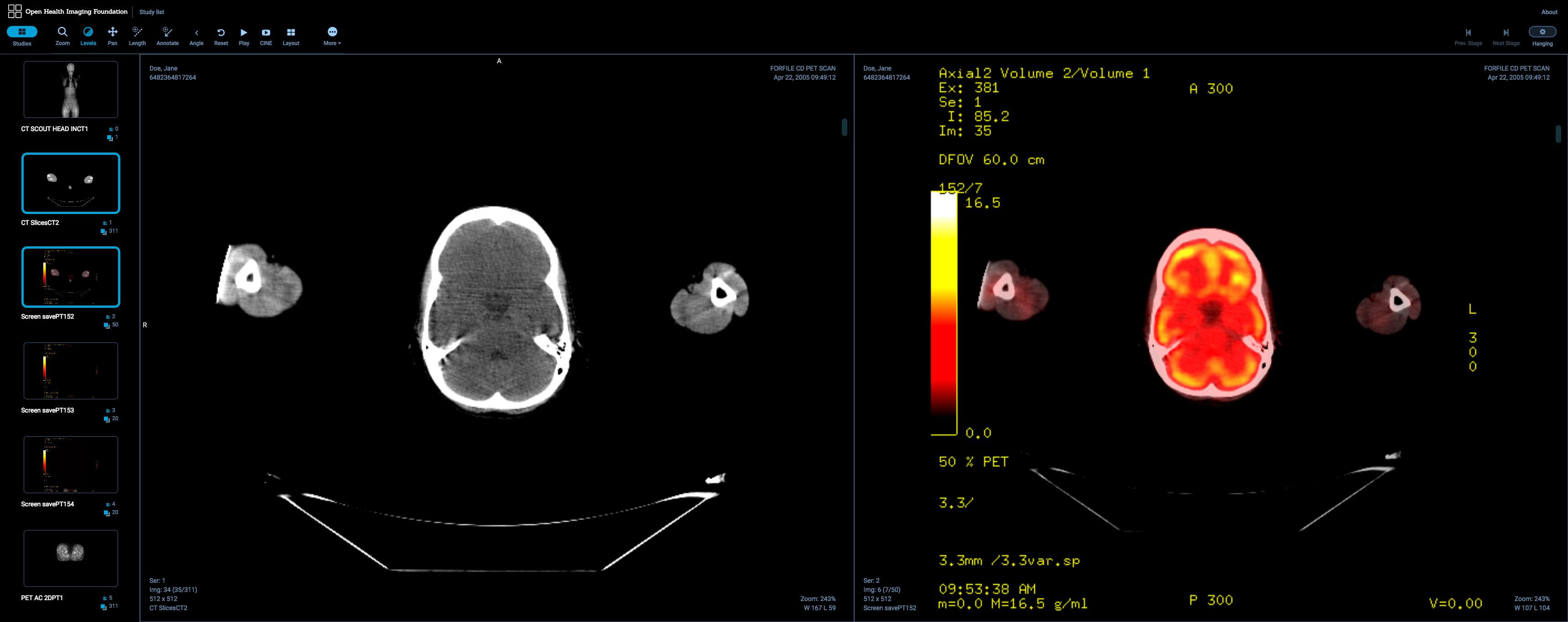 OHIF Viewer Screenshot